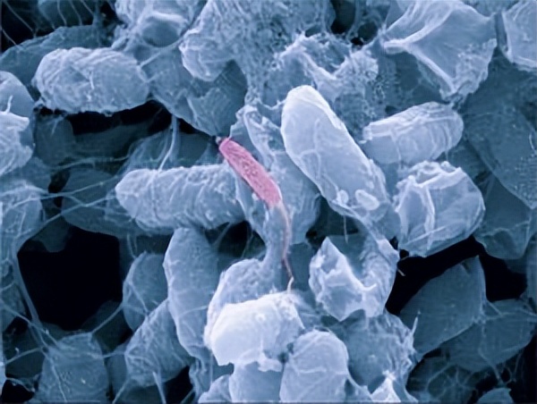 由致病菌引起的食物中毒常见症状,夏季食源性疾病高发