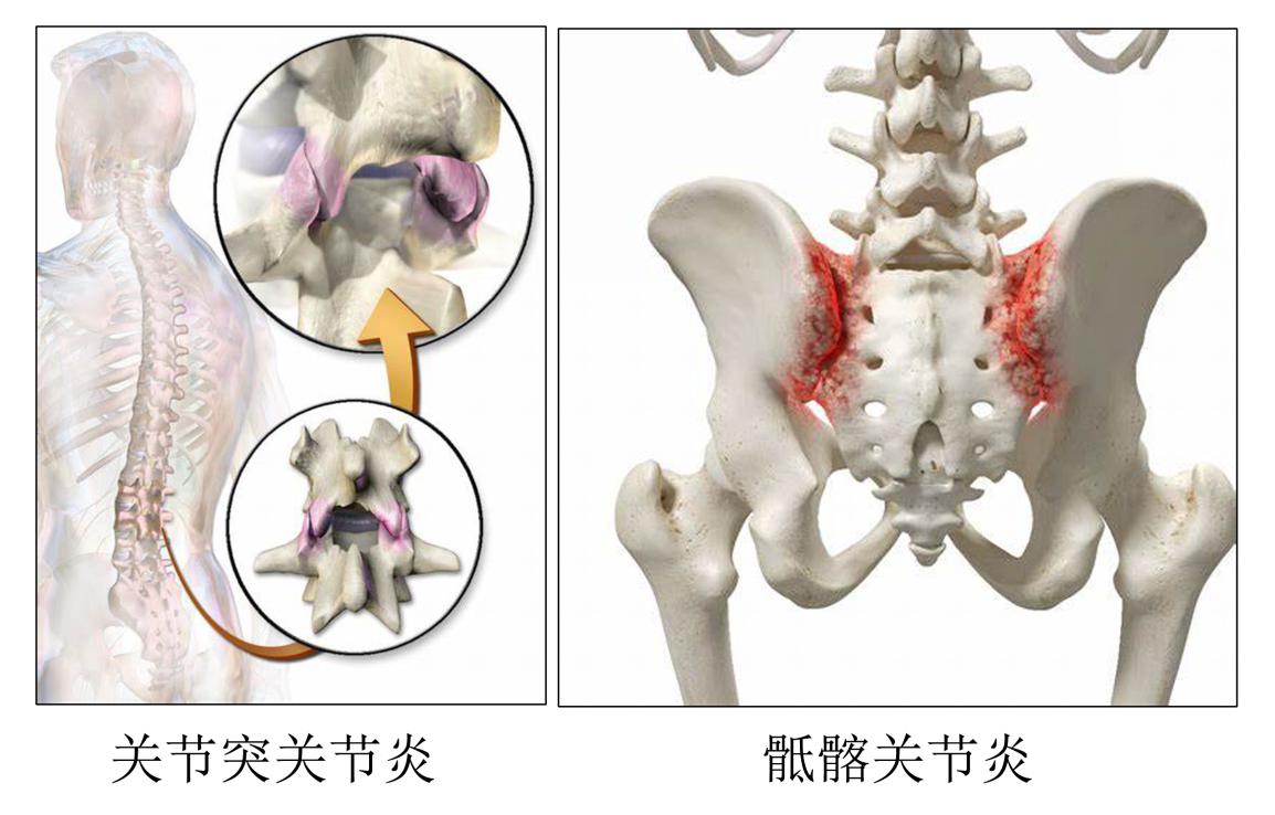 医学科普腰痛的原因 (健康医学科普知识腰痛)