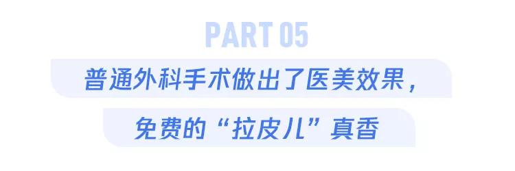 开颅手术后被掀开的头皮多久恢复,开颅手术掀开头皮头皮怎么恢复的