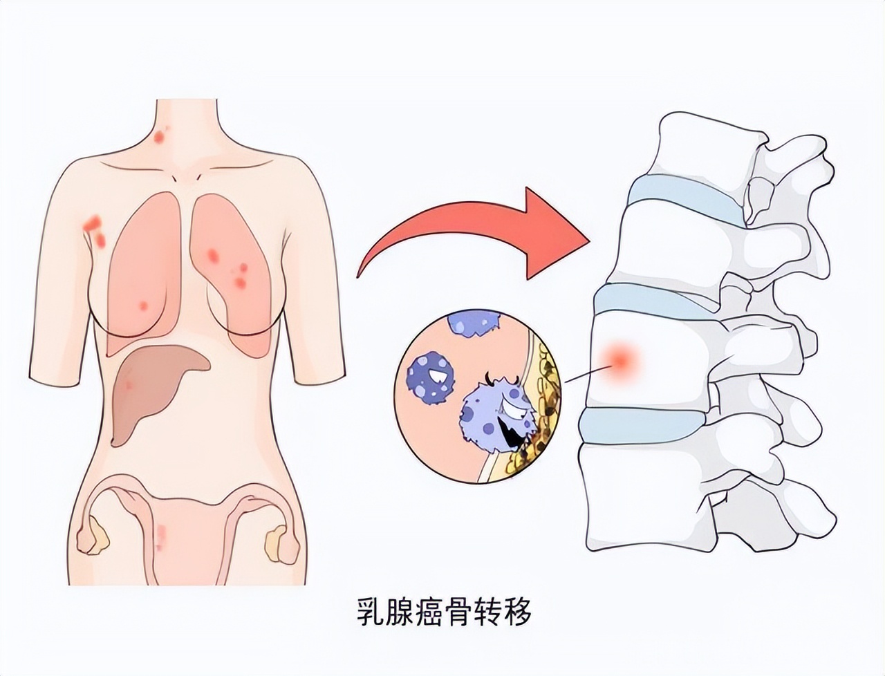 32岁女博士患癌晚期让人惋惜,32岁复旦女博士患癌感悟1600字