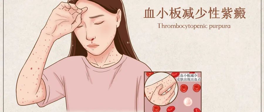 坐月子剪指甲会招风吗,月子里剪指甲有断子绝孙的说法吗