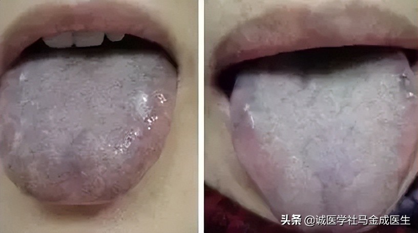 胃胀肚子胀有什么快速消食的方法,胃胀肚子胀最简单的快速解决