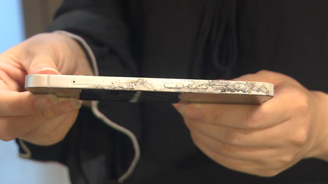 女孩充电时玩手机遭电击面临截肢,女孩手机充电被电击面临截肢