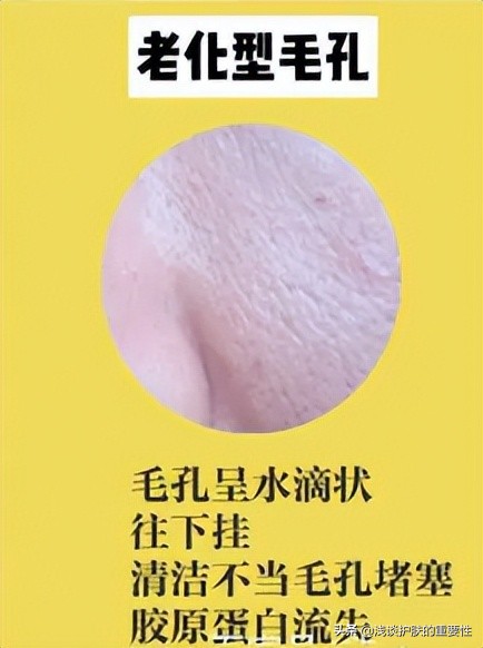 脸上的毛孔粗大用什么护肤品好,脸部毛孔粗大用什么护肤品比较好