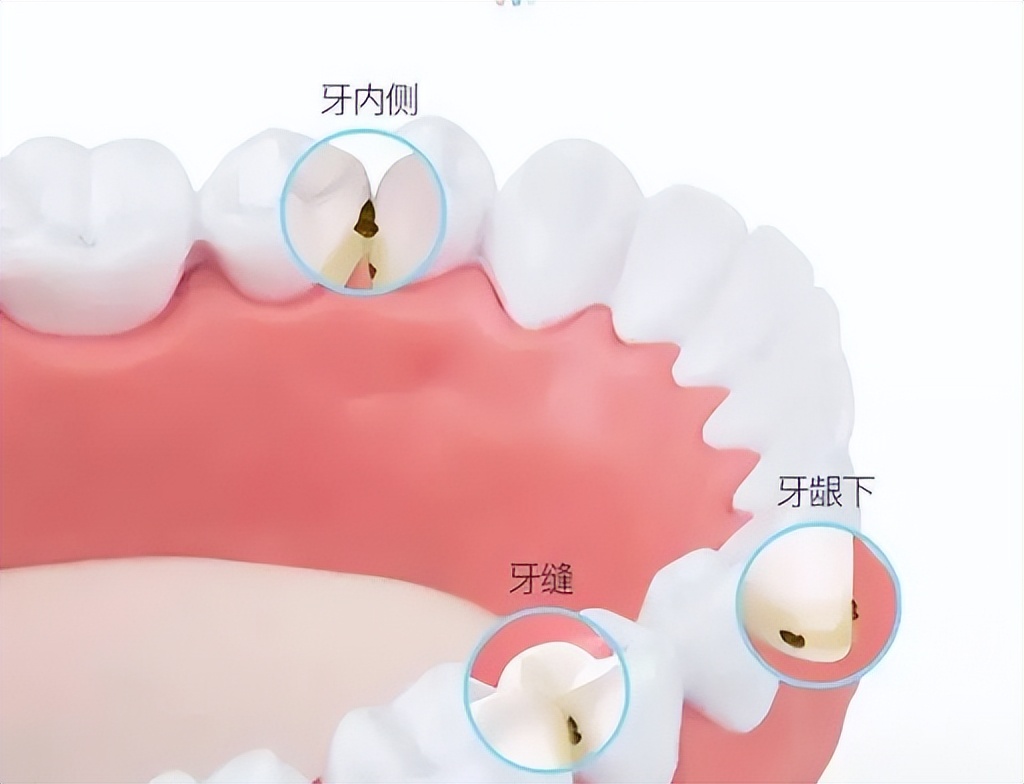 冲牙器测评实验室,冲牙器洁碧拜尔