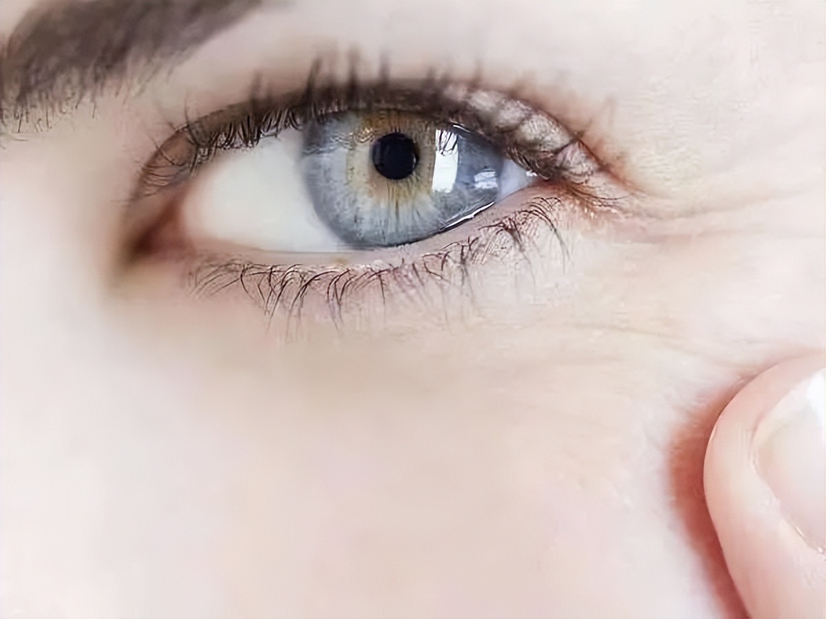 有效去黑眼圈和泪沟方法,黑眼圈泪沟抗衰老