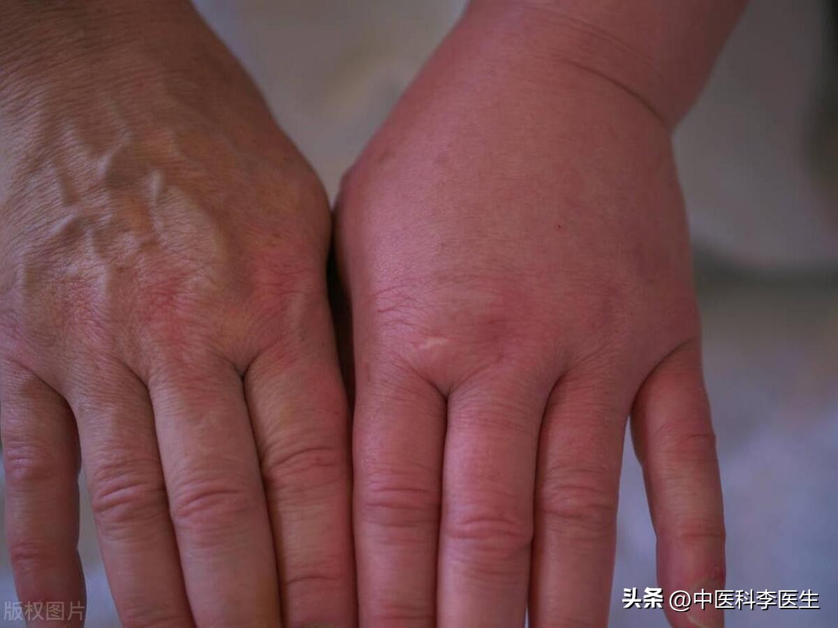 安乃近便宜,安乃近什么时候有效果