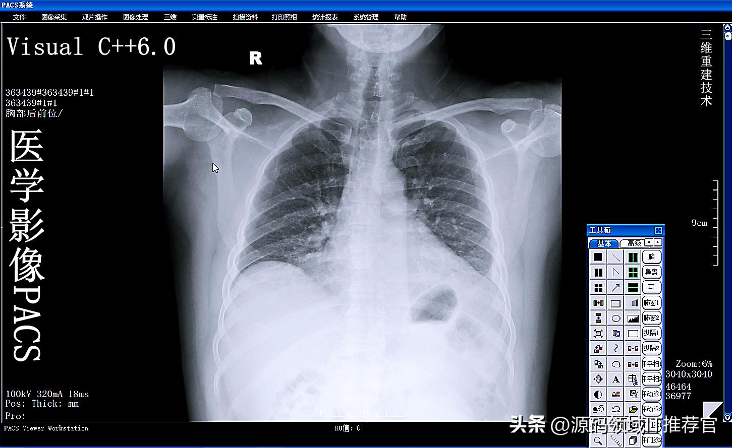 visualc+图像处理,visualc++6.0怎么画图