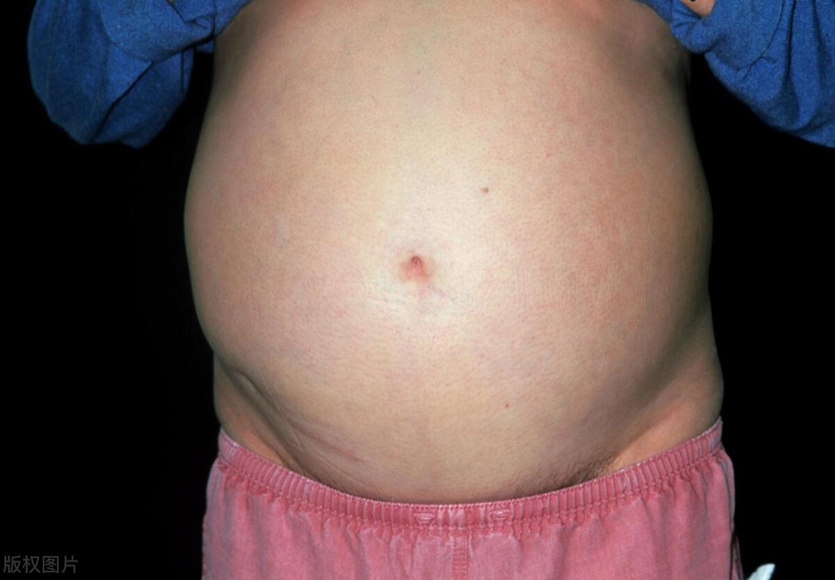 直肠癌晚期可能会有哪些临床表现?