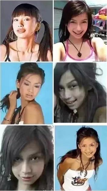 盘点整容失败惨不忍睹的30位女星,那些整容整失败的女明星