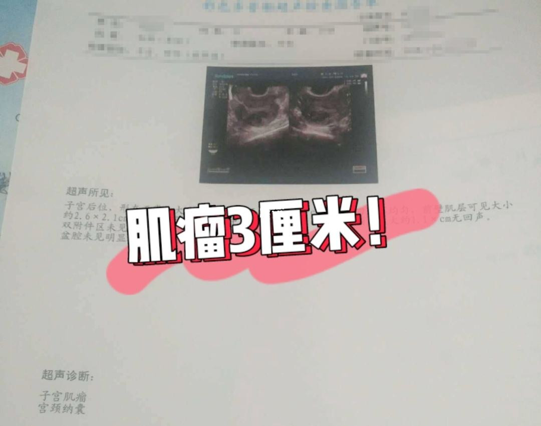 女性身体出现哪些症状一定要警惕,女性出现这六种疾病要注意了