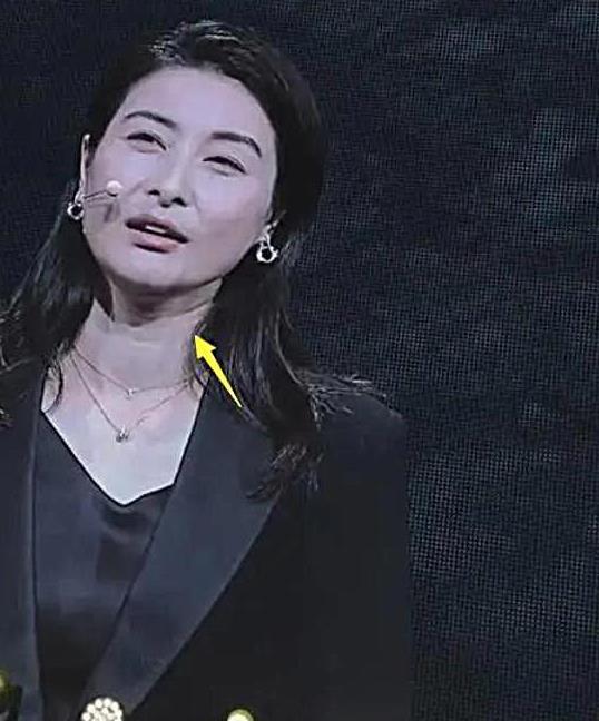 郭晶晶为什么一脸皱纹,郭晶晶罕见戴百万首饰亮相活动