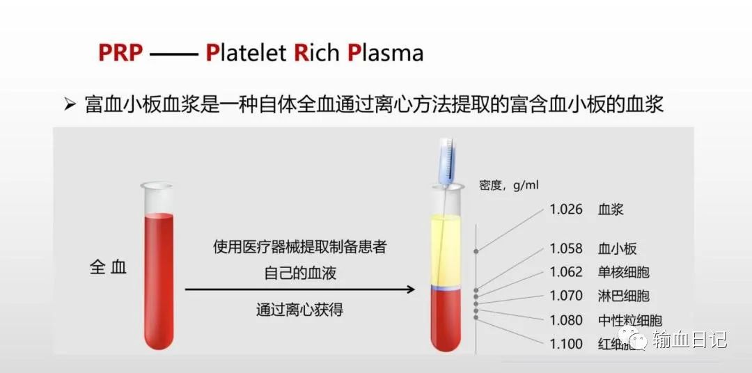 富血小板血浆治疗骨质增生吗,富血小板治疗脂溢性脱发