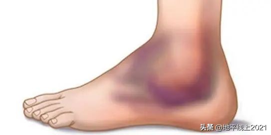 小孩被自行车撞康复要赔偿,孩子不小心被自行车撞了一下