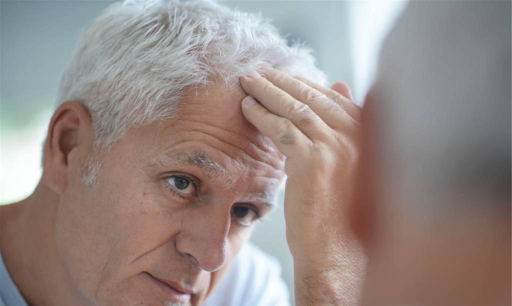 雄性激素脱发是激素多了还是少了,男性45岁还会雄激素脱发吗