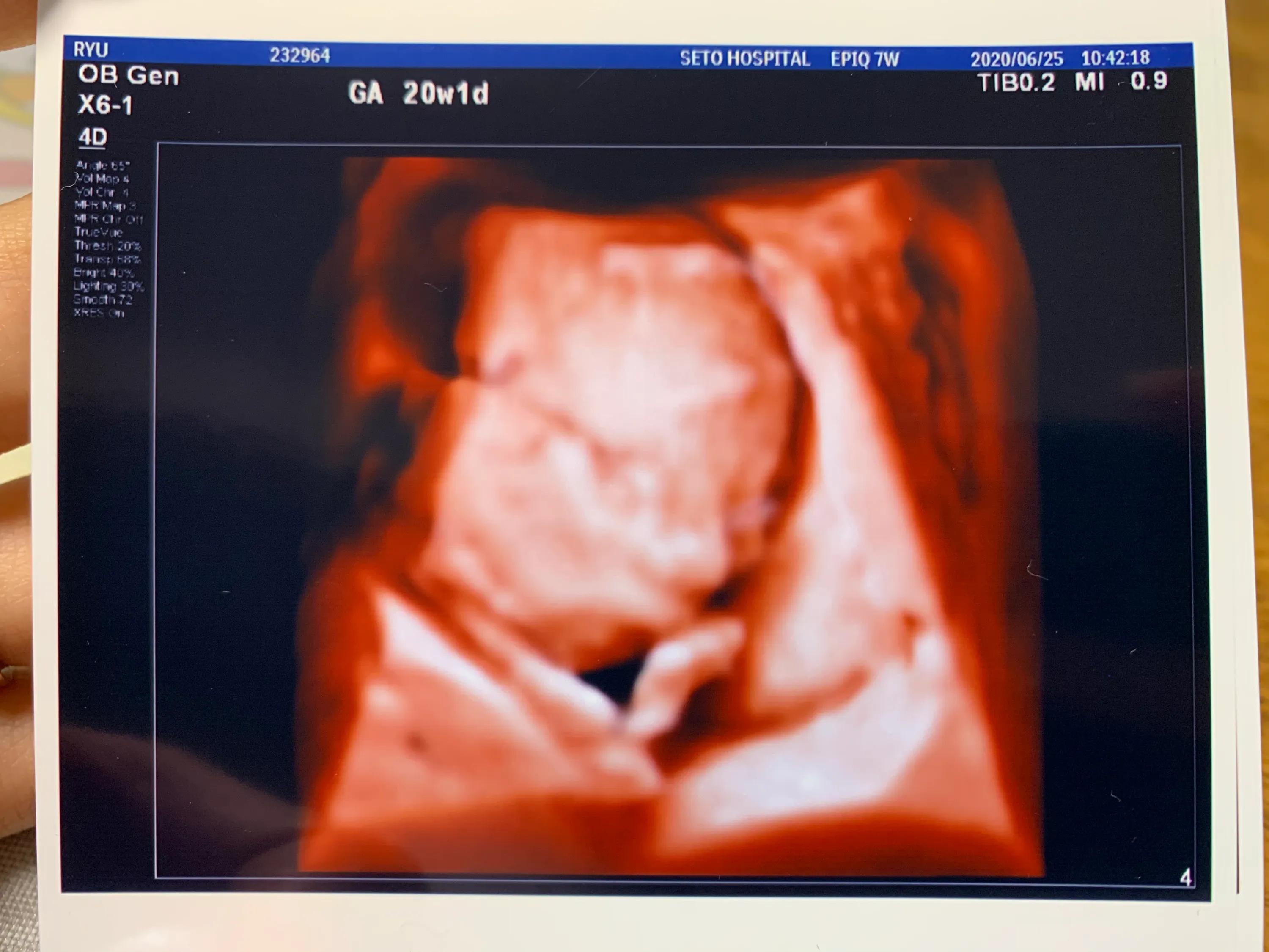 日本产检真实感受,在日本做产检的体验