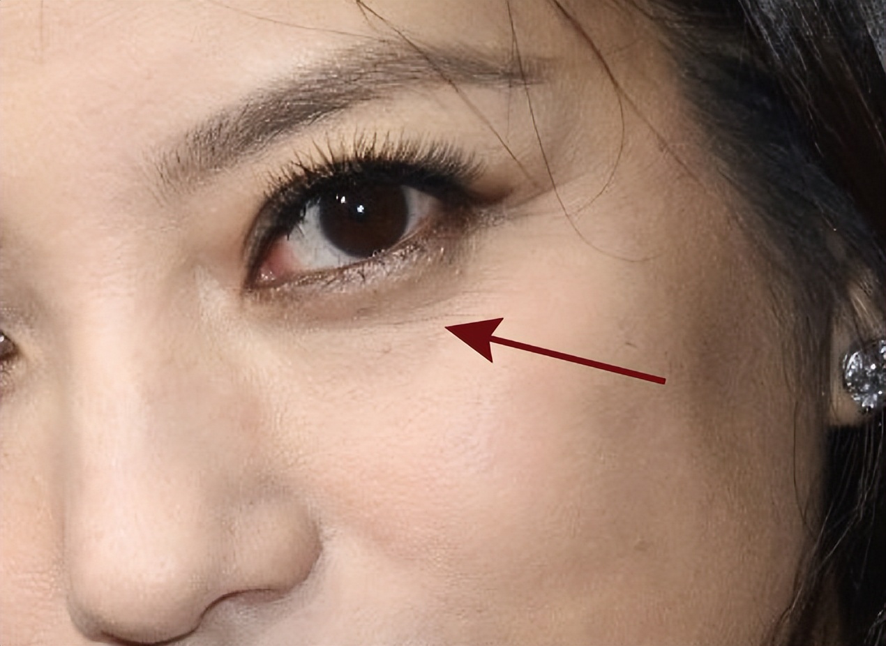 花漾缘面膜,花漾缘祛痘清洁面膜