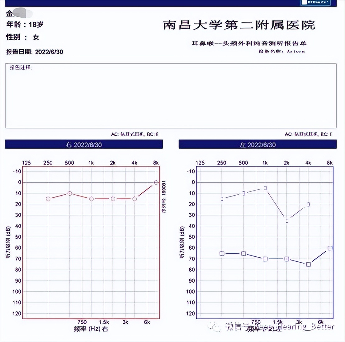 南昌大学第一附属医院鼓膜修复,南昌大学二附院耳鼻喉科专家介绍