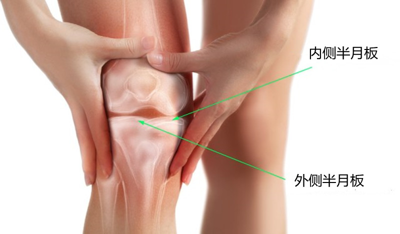 膝盖核磁共振半月板损伤怎么办,膝盖疼痛核磁共振