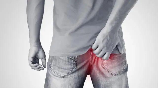 难以启齿的疾病是什么,难以启齿有痔疮怎么办