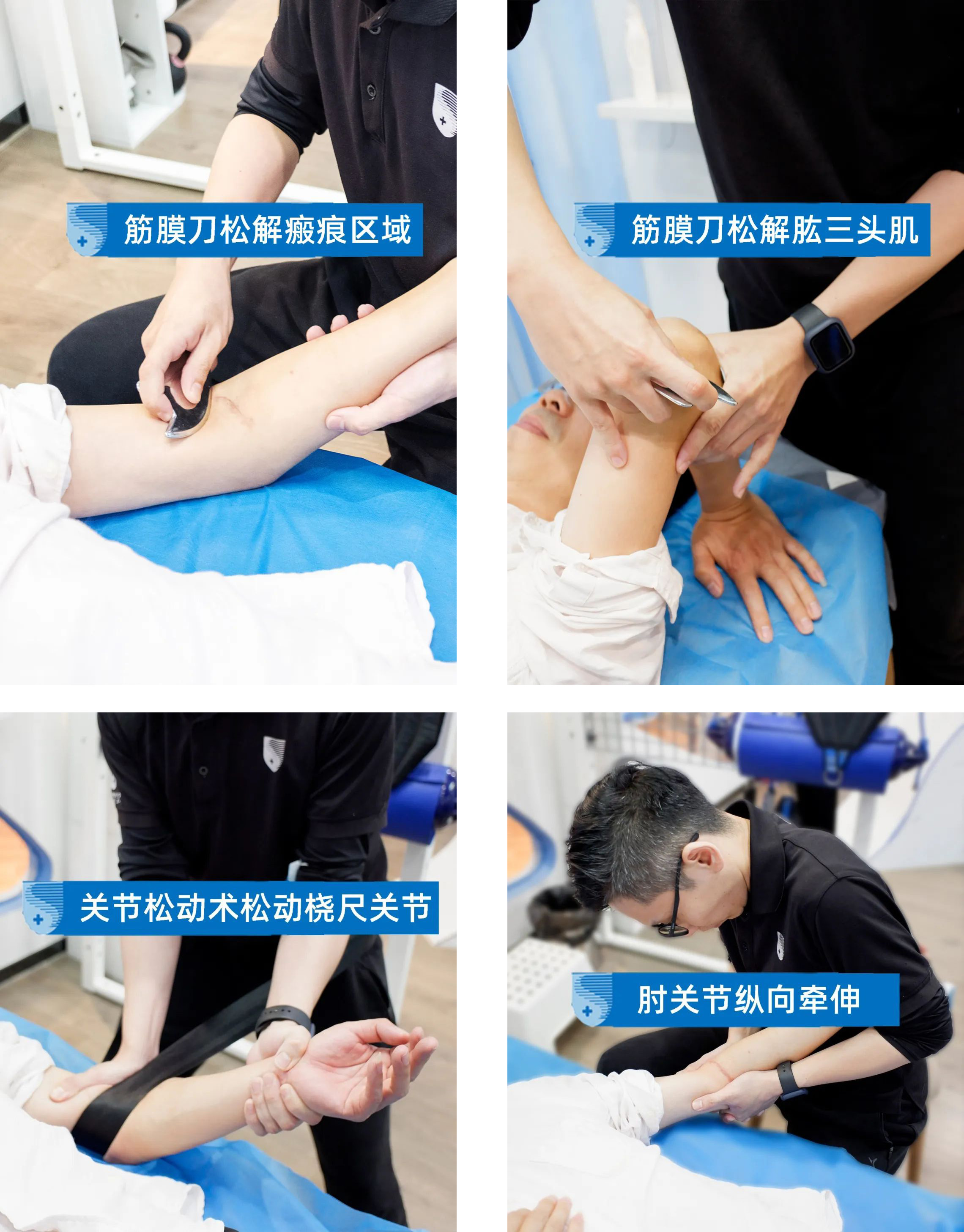 手肘骨折术后肿胀多久会完全消除,手肘骨折恢复后手僵硬康复治疗