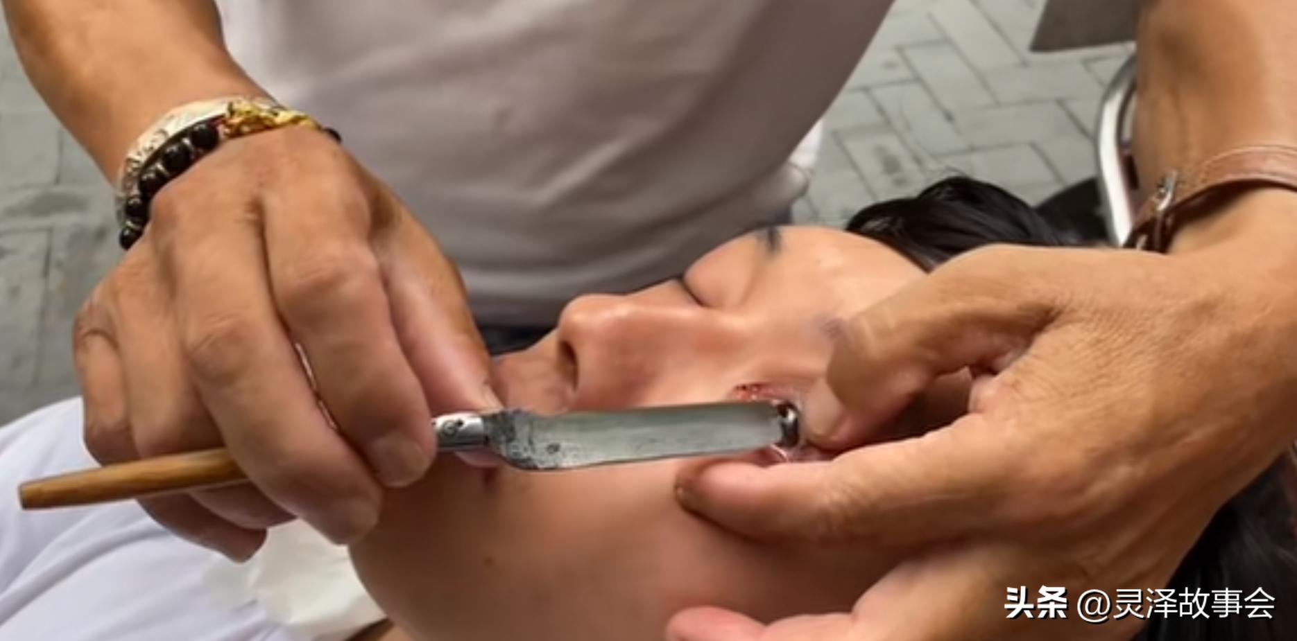 四川绝活刀锋洗眼有什么效果,正宗成都刀锋洗眼视频