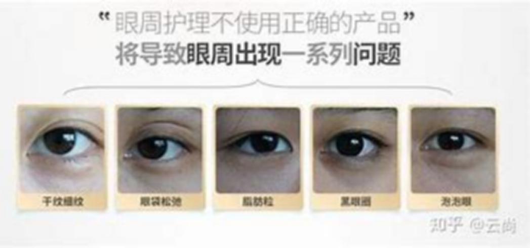 最有效消除抬头纹的产品,超显老的抬头纹去除全攻略get