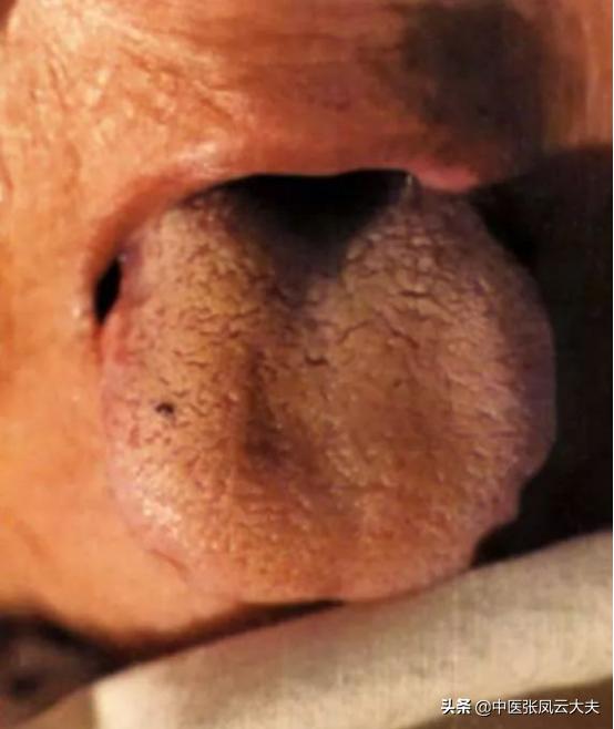 脾肾虚西医诊断是什么,脾阴虚消瘦怎么调理最有效