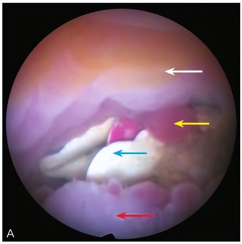 宫腔镜最好的医生,妇科医生科普的14个妇科知识