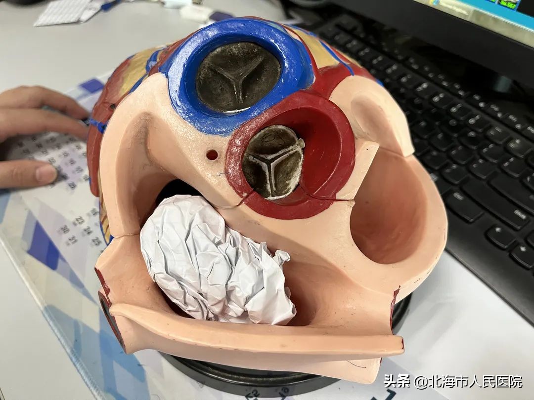 心脏肿瘤18公分大,心脏肿瘤10厘米