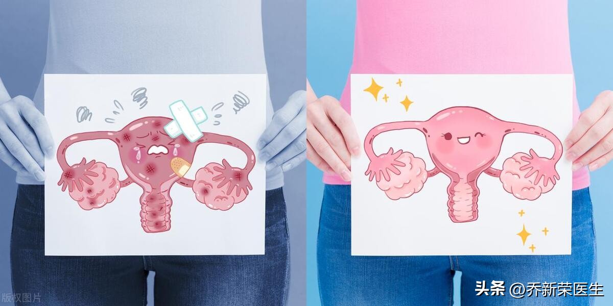 输卵管通而不畅要怎么顺其自然备孕？乔医生告诉您