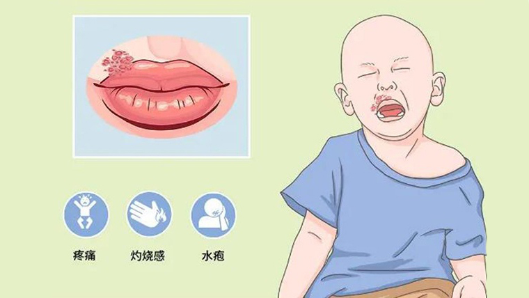 上火引起眼睛不适的症状有哪些,各种上火对应的症状及解决办法