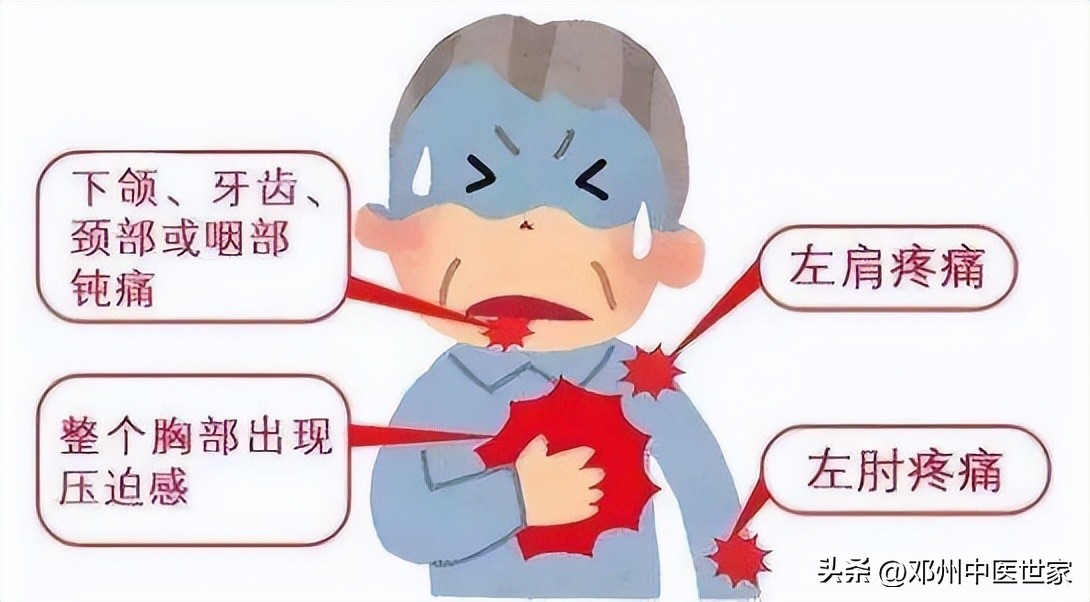 心梗打支架后的中医治疗,心梗消融术