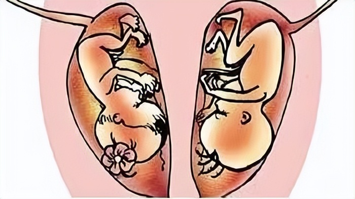 女子婚前检查有2个月身孕,婚前发现子宫有问题