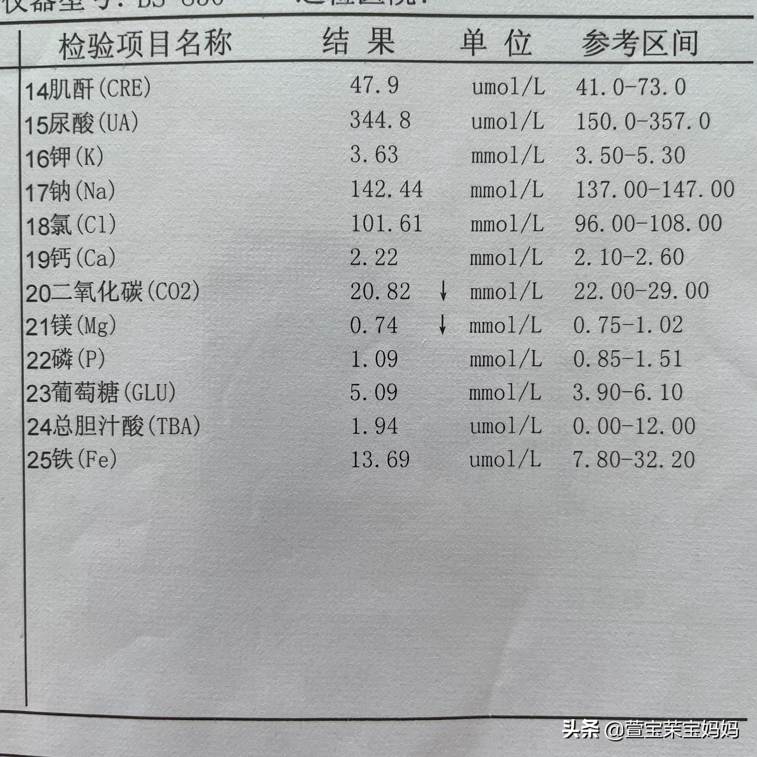 孕期你浮肿了吗,孕期腿肿怎么消