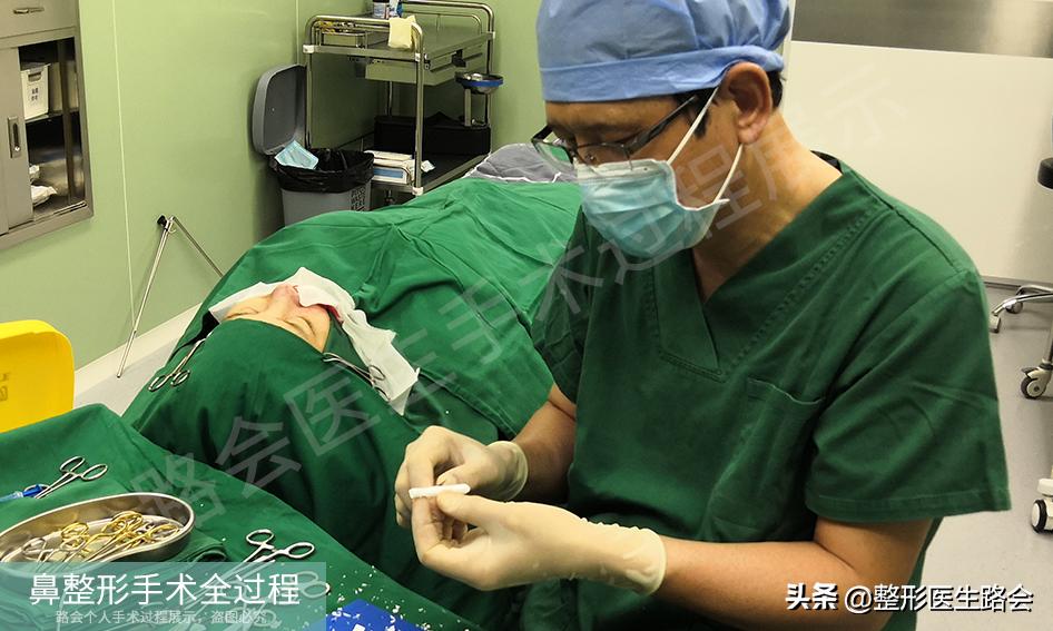 隆鼻手术全过程女生,隆鼻手术到底是怎么进行的