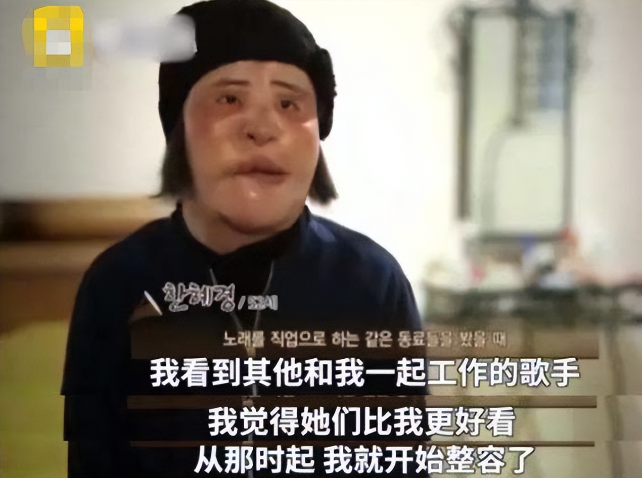 韩慧景整容是打了玻尿酸了吗,韩慧景整容案例