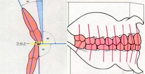 牙齿矫正咬合不对位正常吗,矫正牙齿后面咬合不好怎么办