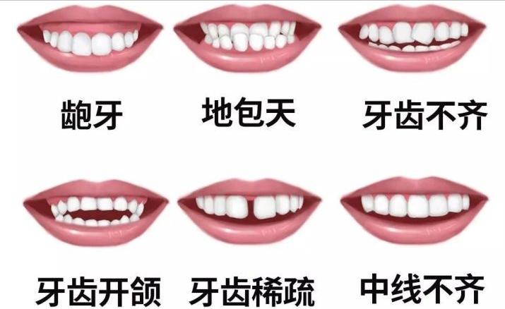 张嘴发出咯噔的声音怎么治,张嘴腮帮子咔哒响还疼怎么治