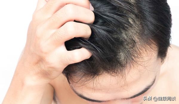 头皮瘙痒有多难受,头皮瘙痒实在恼人