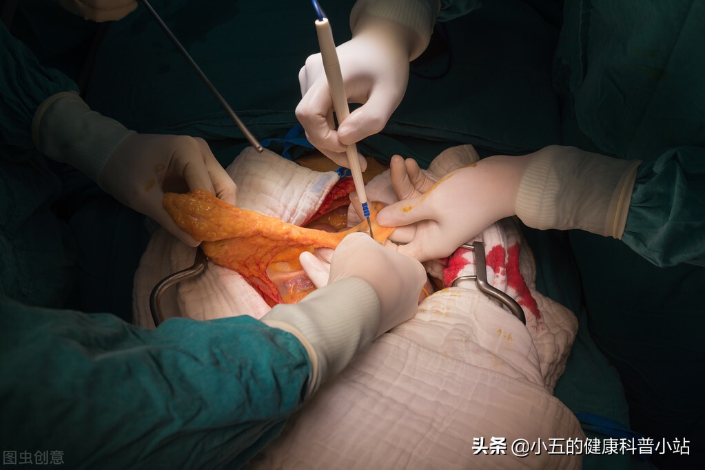 老年人便秘怎么吃麻仁软胶囊,麻仁润肠软胶囊能治好便秘吗