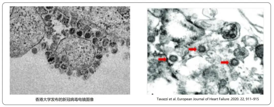 曹彬教授谈新冠,呼吸科曹彬