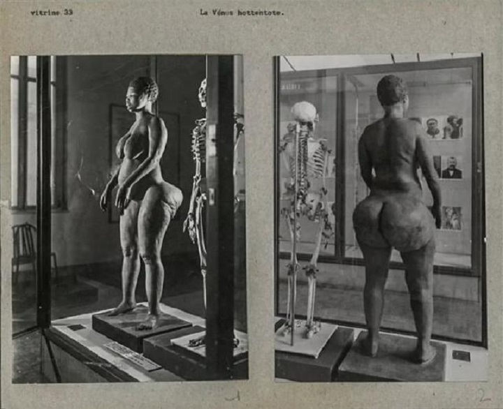 因身形奇特，非洲女孩被关铁笼当动物展览了5年，死后被制成标本