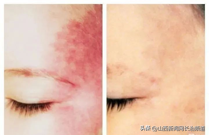 长治市人民医院整形科,长治市人民医院整形美容