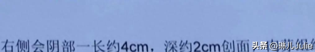 女子被大狗咬伤隐私部位，女子崩溃：留下了疤痕，会对未来有影响