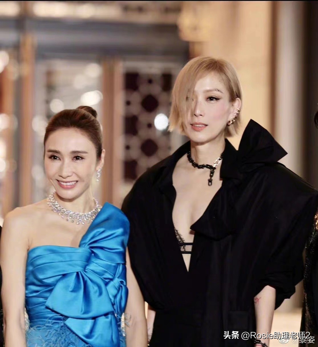 黎姿的下巴怎么改善的,黎姿面部变化