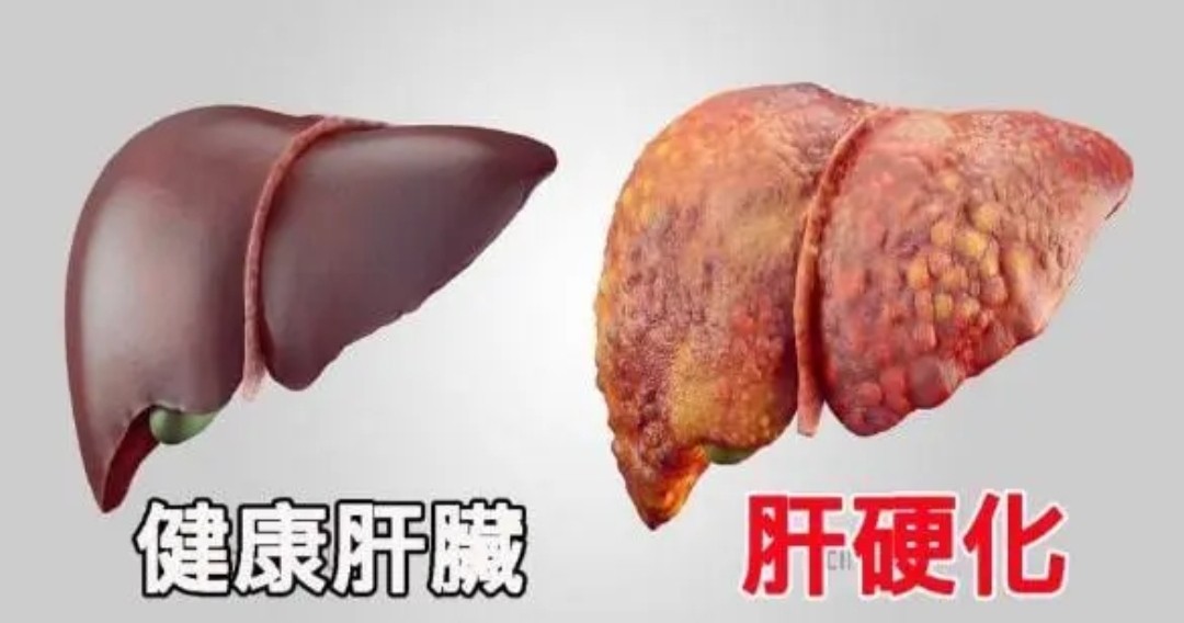 身上出现了大面积小红点不痛不痒,身上出现小红点不痛不痒什么原因