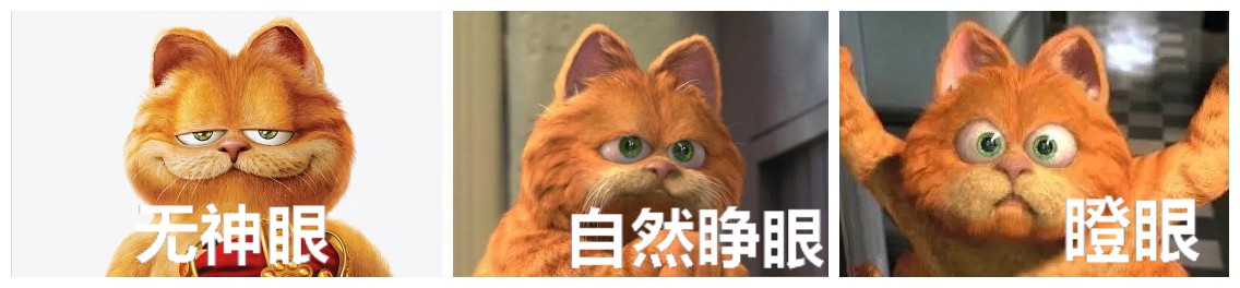 眼部提肌手术副作用,眼部提肌术可以不割双眼皮吗