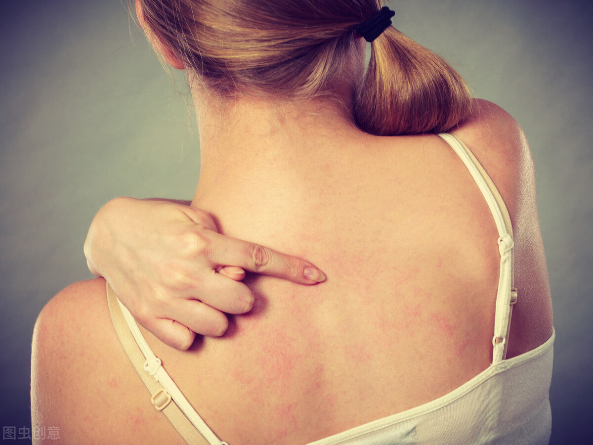 容易过敏的药有哪些,容易过敏的药物要皮试的