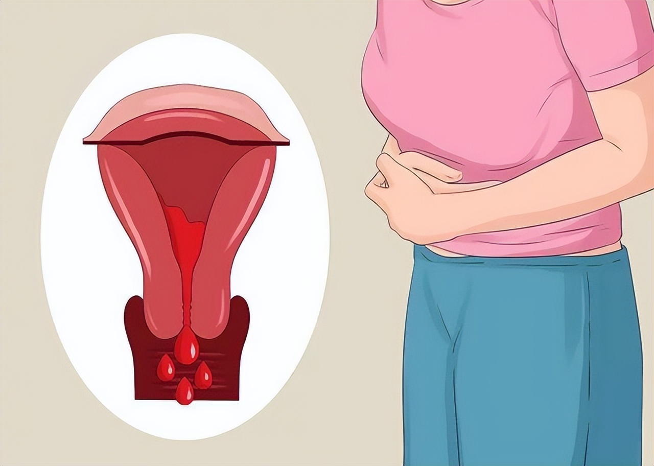医生说女性来例假十大禁忌,女人月经期间千万别做这四件事情